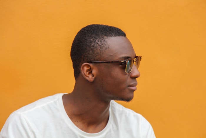 how to manage a receding hairline